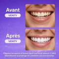 Bandes blanchissantes Venty - Kit